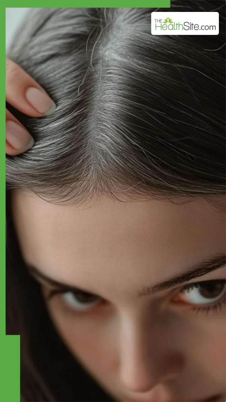 तेजी से बाल सफेद होने लगे तो क्या करना चाहिए?