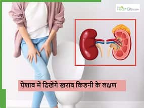 एक दिन भी इग्नोर न करें रात को पेशाब में दिख रहे ये 5 लक्षण, किडनी से धो बैठेंगे हाथ एक दिन भी इग्नोर न करें रात को पेशाब में दिख रहे ये 5 लक्षण, किडनी से धो बैठेंगे हाथ
