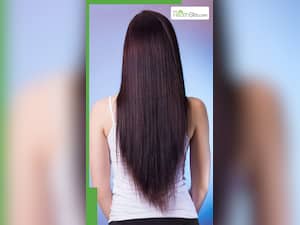 हेयरफॉल कम करने के लिए खाएं ये फूड