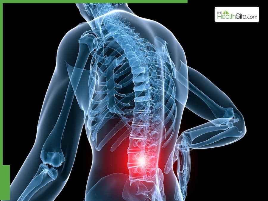 Overcoming Pain: A Case Study On Ayurvedic Healing For Spinal Issues