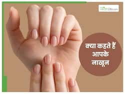 इस सीरियस बीमारी का संकेत हैं नाखूनों में लकीरे होना, समय पर नहीं पहचाना तो जाना पड़ेगा अस्पताल