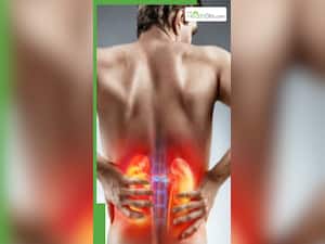 इन चीजों के सेवन से शरीर में बनने लगती है पथरी