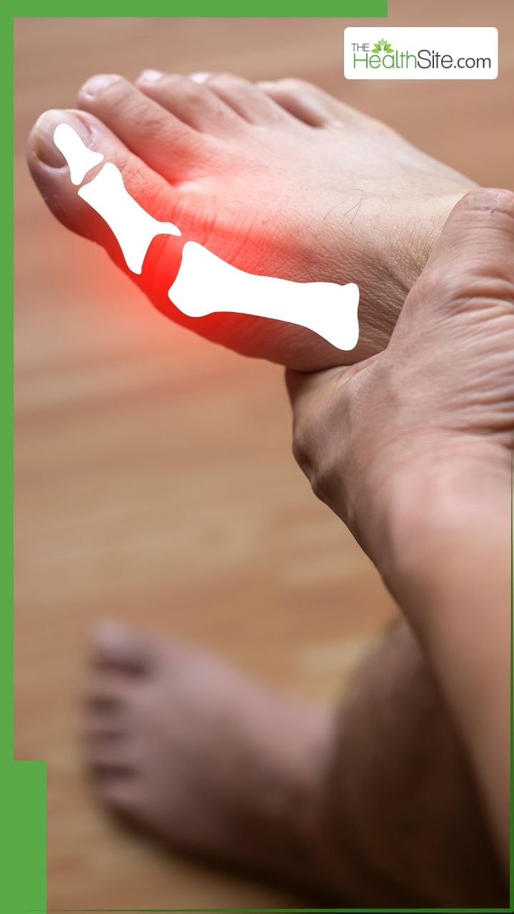 यूरिक एसिड कंट्रोल करेंगी ये 8 हेल्दी चीजें