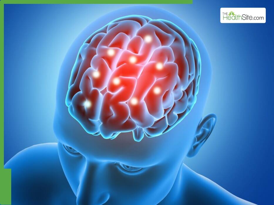 World Stroke Day 2024: A Doctor Wants To Debunk These 4 Common Stroke ...