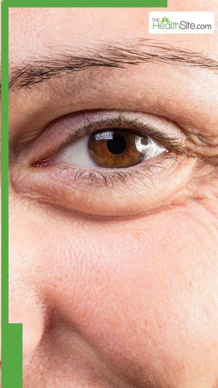 उम्र से पहले बुजुर्ग बनाती हैं खानपान की ये आदतें