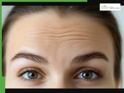 माथे पर झुर्रियां रोकनी हैं तो नारियल तेल के साथ लगाएं ये 2 चीजें