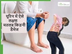 90 फीसद लोग इग्नोर कर देते हैं पेशाब में दिख रहे Kidney Damage के ये 5 अजीब लक्षण, कैसे करें इनकी पहचान