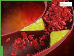 High Cholesterol Management: 5 Tips To Flush Out Bad LDL Naturally And Prevent Nighttime Stroke