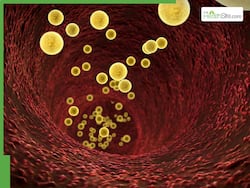 Tips To Lower LDL Cholesterol: Avoid These 6 Foods That Can Spike Bad Cholesterol Instantly