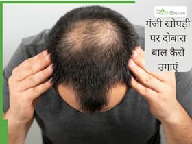नारियल तेल में मिलाकर लगा लें ये 7 चीजें, गंजी हो गई खोपड़ी में भी उगने लगेंगे बाल
