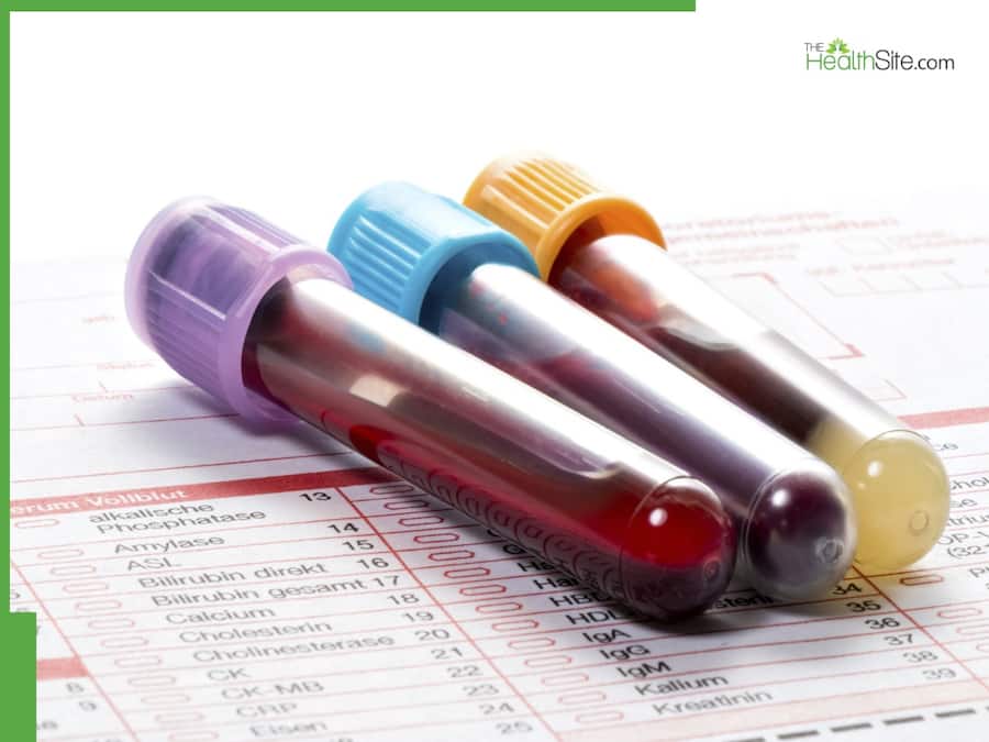 The Impact Of Lifestyle On Lab Results: What You Should Know Before Your Next Test