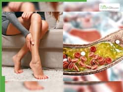 Clogged Arteries Symptoms In 40s: Top 5 Unusual Signs of Heart Blockage In Legs and Feet at Night