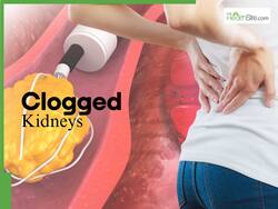 Clogged Kidneys Symptoms At Night: 5 Unusual Signs of Blocked Kidneys In Legs and Feet After 10PM
