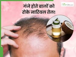 गंजे सिर पर बाल उगाने के लिए नारियल तेल में मिलाकर लगाएं ये 2 चीजें, कुछ दिन दिन में निकलने लगेंगे Baby Hair