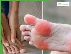Diabetes Symptoms At Night: Diabetic Foot And 5 Other Unusual Signs of High Blood Sugar