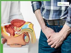 5 Effective Lifestyle Modifications to Help Manage Benign Prostatic Hyperplasia
