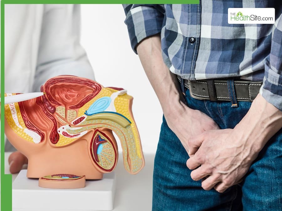 Enlarged Prostate Symptoms: 5 Lifestyle Tips to Manage the Signs of Benign Prostatic Hyperplasia Naturally