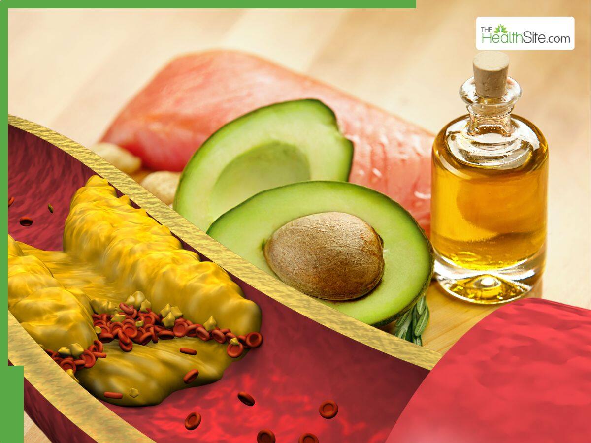 Good Fats For High Cholesterol 5 Superfoods To Flush Out LDL