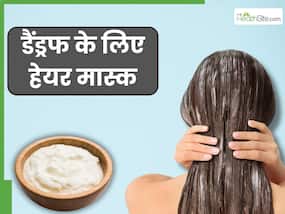सर्दियों में डैंड्रफ से छुटकारा पाने के लिए लगाएं ये 3 होममेड हेयर मास्क, तुरंत दिखेगा असर