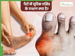 पैरों में दिखने लगे ये 5 लक्षण तो समझ जाएं बन चुका है यूरिक एसिड का क्रिस्टल, तुरंत कराएं जांच