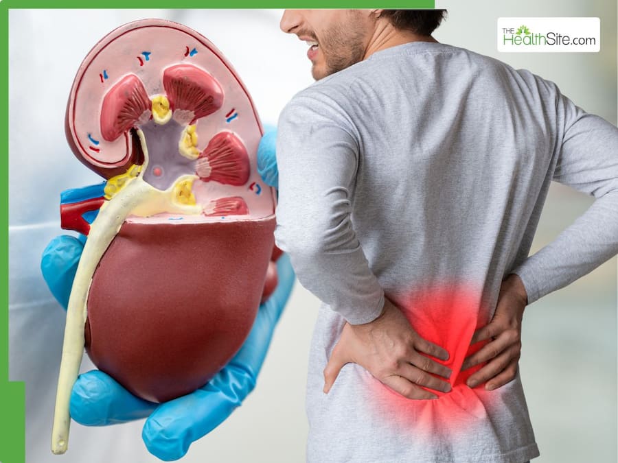 Kidney Damage Prevention: 5 Effective Lifestyle Tips for Maintaining Renal Health Naturally Without Surgery