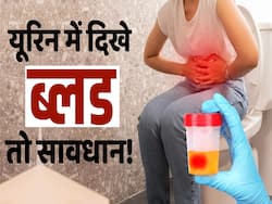 Kidney Fungal Infection: पेशाब में खून दिखना हो सकता है किडनी में इंफेक्शन का संकेत!