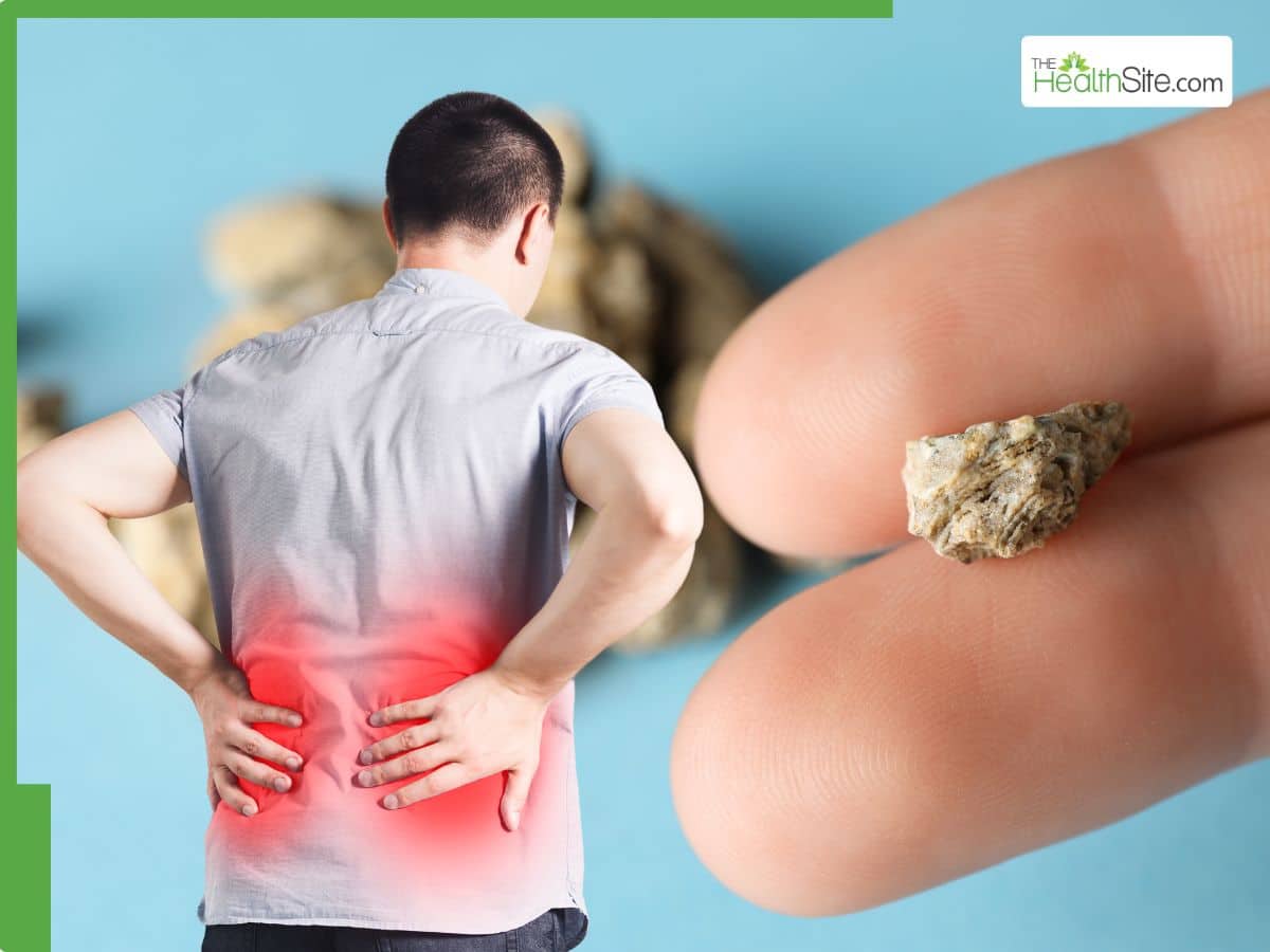 how do you get rid of kidney stones
