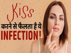 Kissing and Cold Sores: किस करने से और भी ज्यादा फैलता है ये इंफेक्शन!