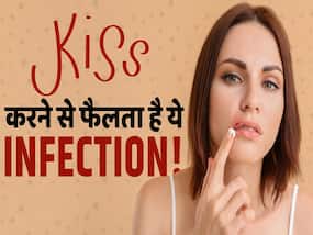Kissing and Cold Sores: किस करने से और भी ज्यादा फैलता है ये इंफेक्शन! Kissing and Cold Sores: किस करने से और भी ज्यादा फैलता है ये इंफेक्शन!