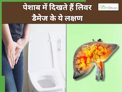 लिवर डैमेज होने से पहले पेशाब में दिखते हैं ये 3 संकेत, पैरों में भी आ जाती है सूजन