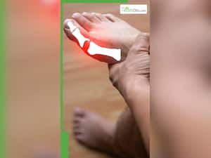 यूरिक एसिड बढ़ने पर शरीर में दिखाई देते हैं ये 8 लक्षण