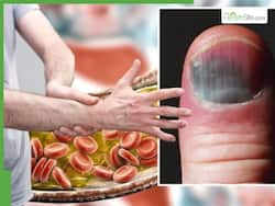 Signs of High Cholesterol At Night: 5 Warning Symptoms of Clogged Arteries After 10PM