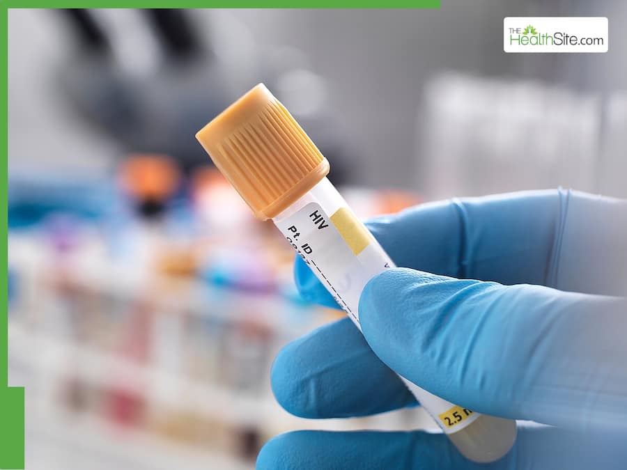 World AIDS Day 2024 The Role Of Molecular Diagnostics In Monitoring