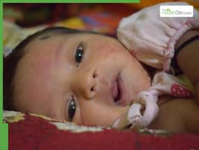 Atopic Dermatitis: Beware Of This Skin Condition That Causes A Lot Of Distress In Newborns