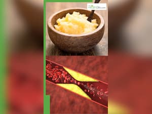 कोलेस्ट्राल  को कम करती हैं ये 8 चीजें