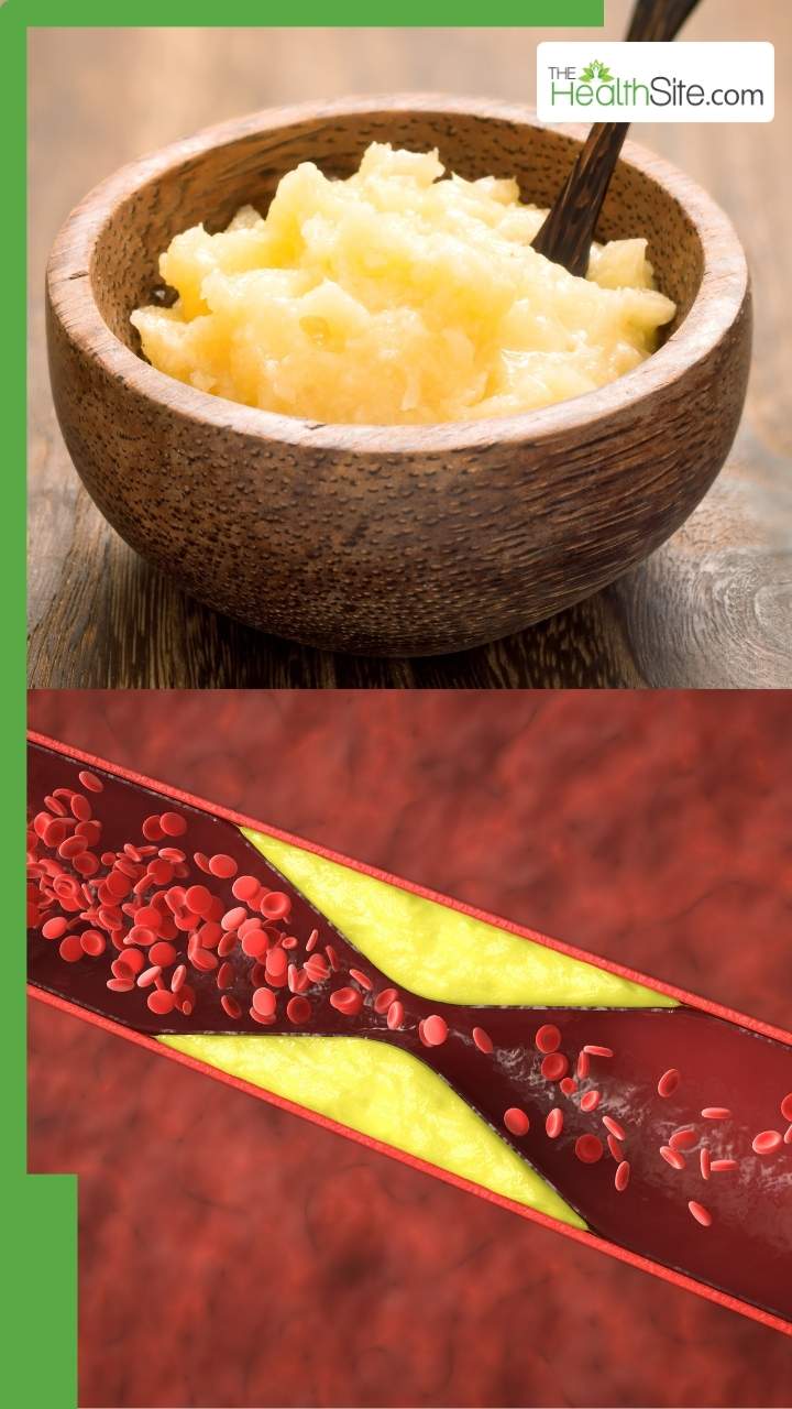 рдХреЛрд▓реЗрд╕реНрдЯреНрд░рд╛рд▓ рдХреЛ рдХрдо рдХрд░рддреА рд╣реИрдВ рдпреЗ 8 рдЪреАрдЬреЗрдВ