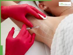 The Role Of Botox In Treating Hyperhidrosis: A New Age Solution For Excessive Sweating