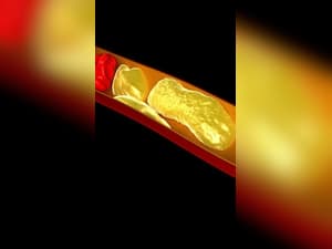 7 Best Herbs And Spices To Lower Cholesterol Levels Naturally