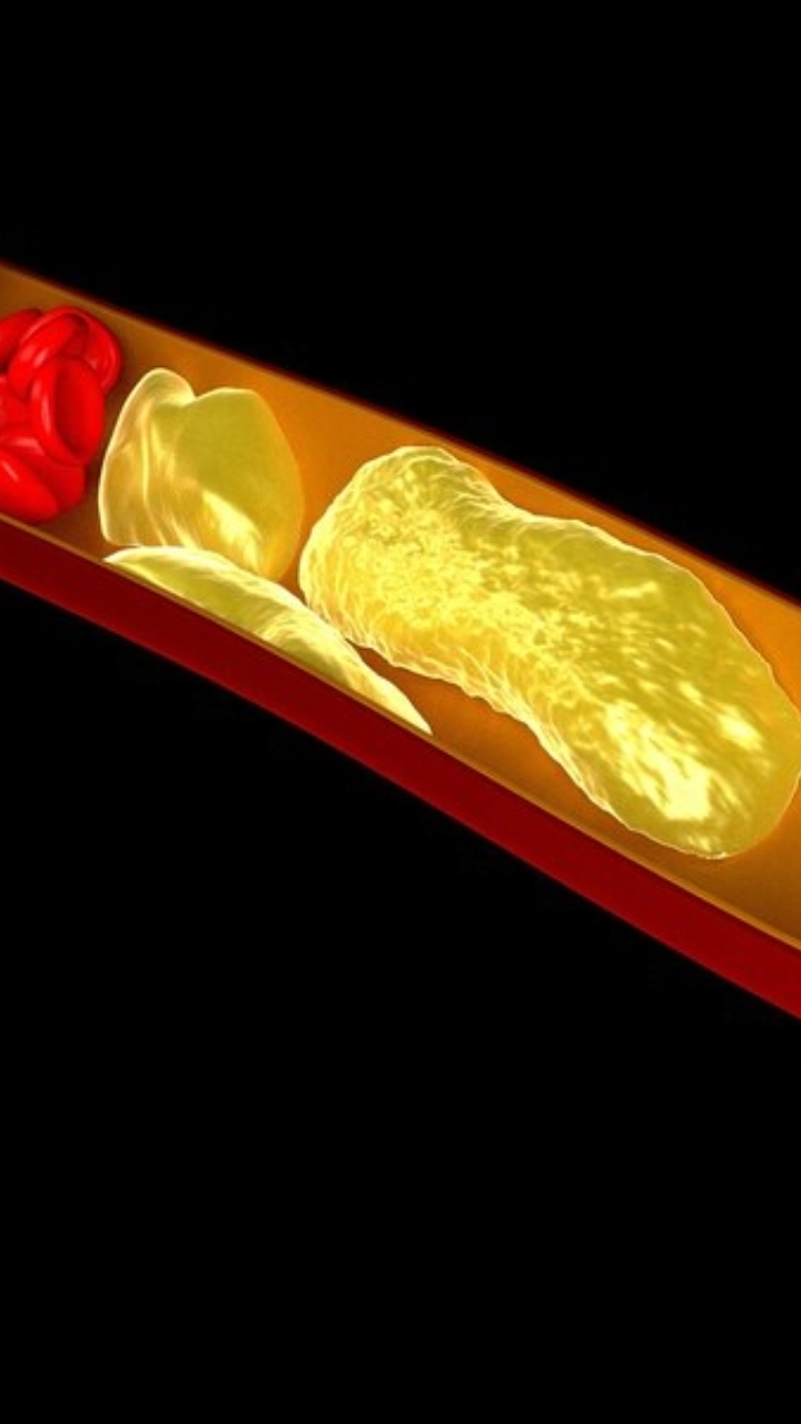 7 Best Herbs And Spices To Lower Cholesterol Levels Naturally