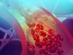 Tips To Clear Clogged Arteries Without Surgery: Here Are 8 Foods You Must Consume Every Day