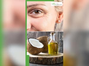 नारियल तेल से ऐसे करें झुर्रियां कम