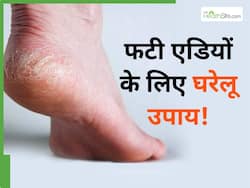 सर्दियों में फटी एड़ियां अब नहीं करेंगी परेशान, ये 3 नुस्खे आजमाएं आज से ही, मिलेगा आराम
