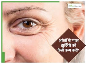 कम उम्र में आंखों के पास झुर्रियां क्यों पड़ती हैं? जानिए इसे रोकने के 5 जबरदस्त तरीके