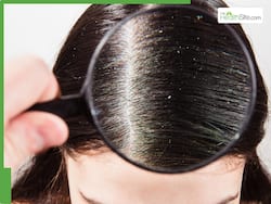 Winter Hair Care: How To Prevent Increasing Dandruff Problems In Cold Weather
