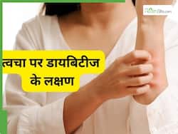 ड्राई स्किन से लेकर झाइयां डायबिटीज में हो सकती हैं ये 5 स्किन प्रॉब्लम्स, 10 में से 8 लोग कर जाते हैं इग्नोर