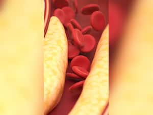 7 Best Dry Fruits To Lower Cholesterol Levels Naturally