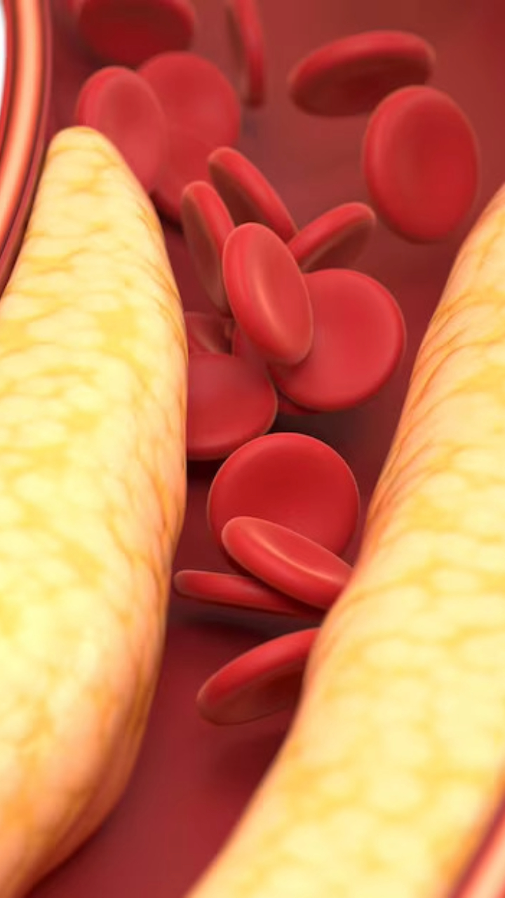 7 Best Dry Fruits To Lower Cholesterol Levels Naturally