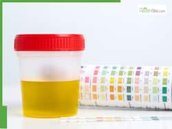 Foamy Urine: Is It A Sign Of A Serious Underlying Health Issue?