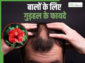 इस लाल फूल को नारियल तेल के साथ लगा लें सिर में, गंजे सिर पर उग आएंगे नये बाल, हेयर ग्रोथ भी होगी फटाफट