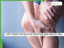Uric acid: शरीर में अगर दिखने लगें ये 5 लक्षण तो समझ लीजिए बढ़ने लग सकता है यूरिक एसिड